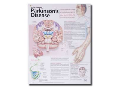 Parkinsons Wall Chart